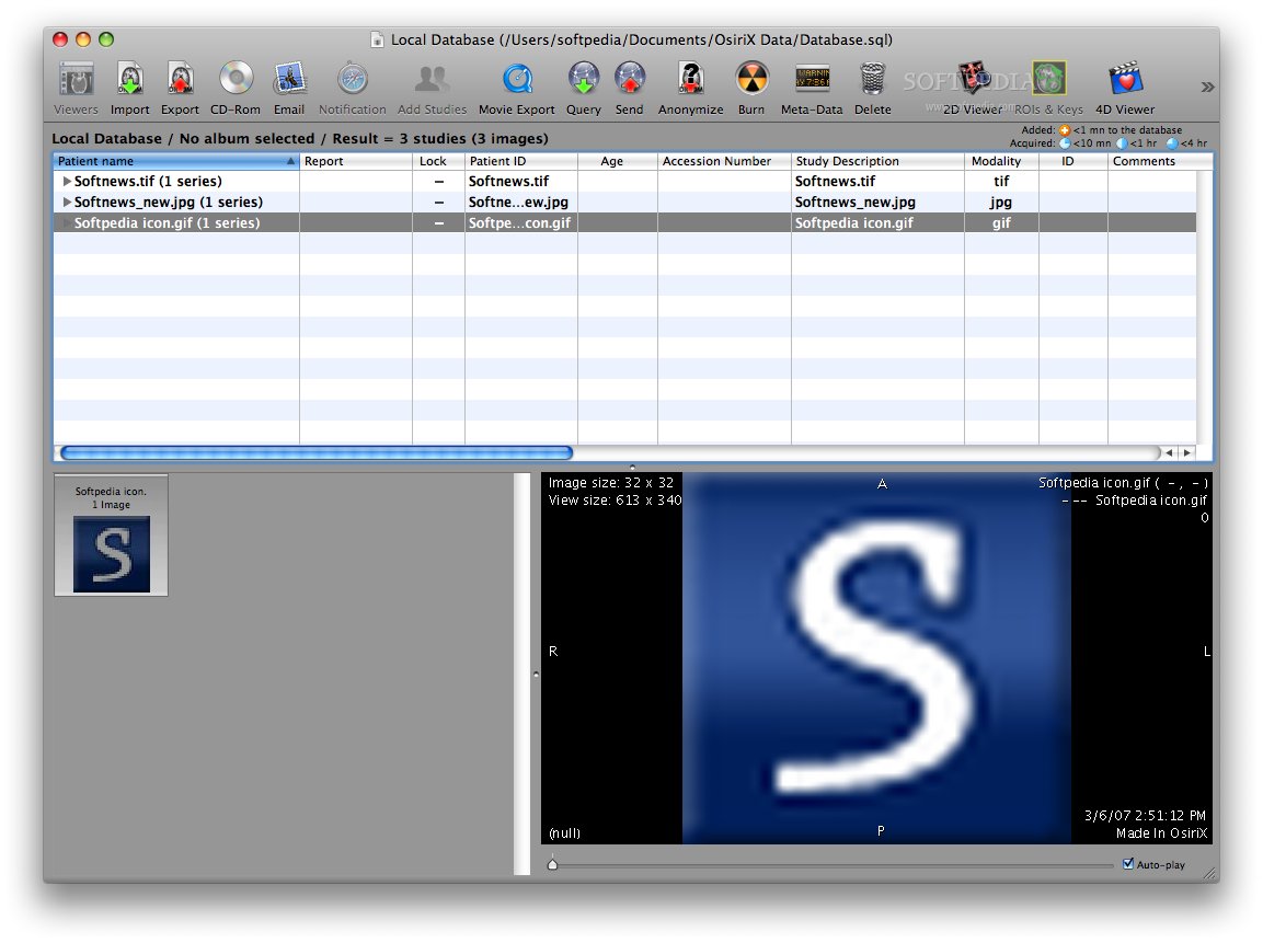 instal the last version for mac Sante DICOM Viewer Pro 14.0.1